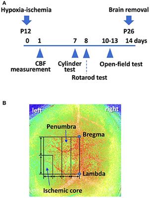 Bone Morphogenetic Protein (BMP)-3b Gene Depletion Causes High Mortality in a Mouse Model of Neonatal Hypoxic-Ischemic Encephalopathy